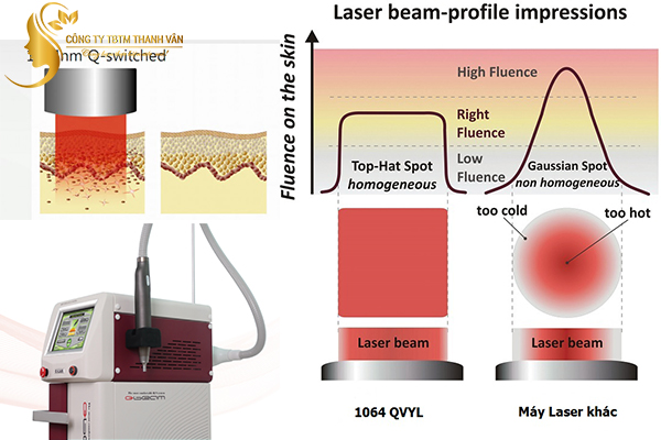 Máy laser thẩm mỹ trị nám, tàn nhang, xóa xăm Q-Beam